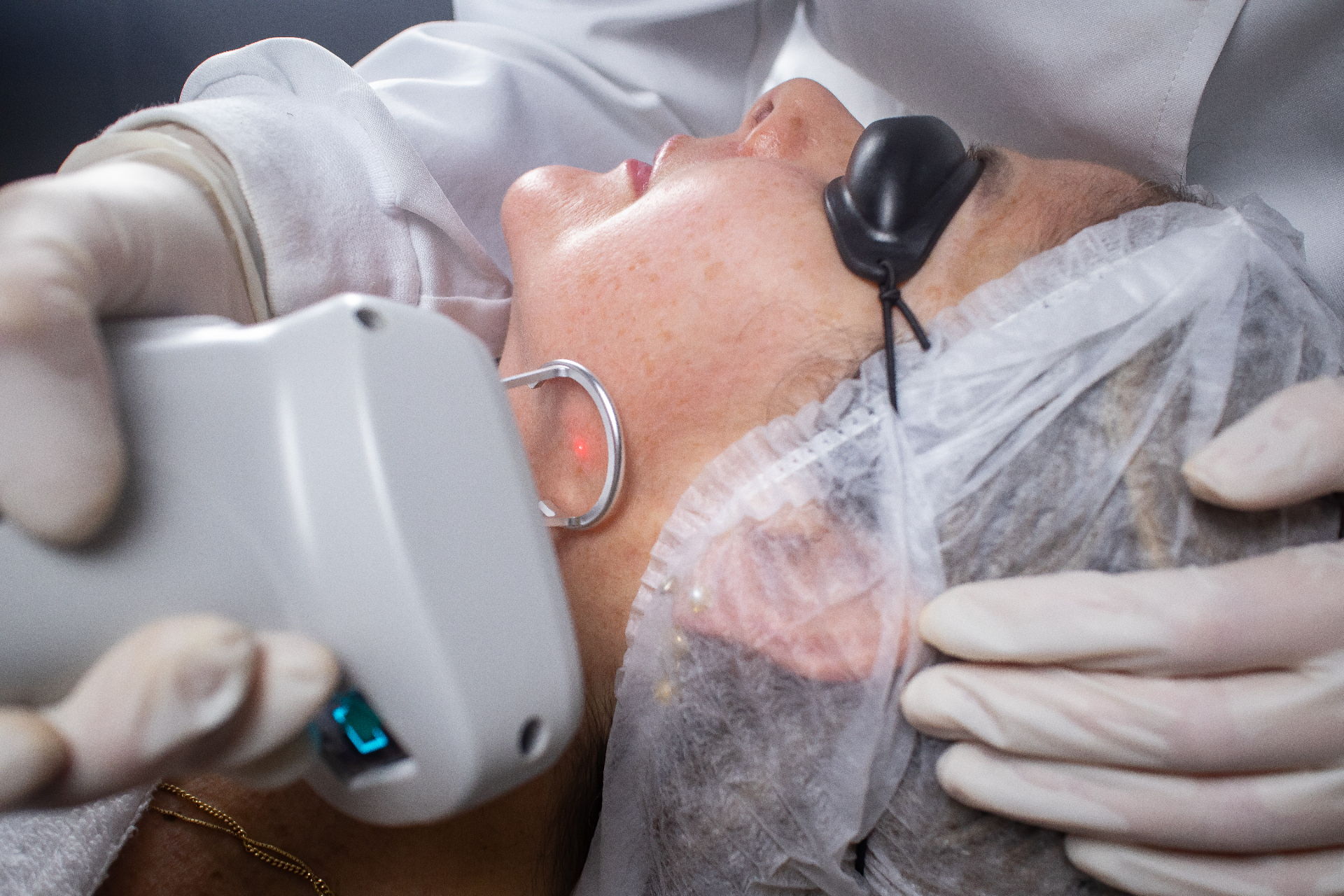 Sessão clínica com o laser Pisom Thulium